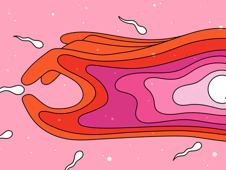 Gender Selection via IVF